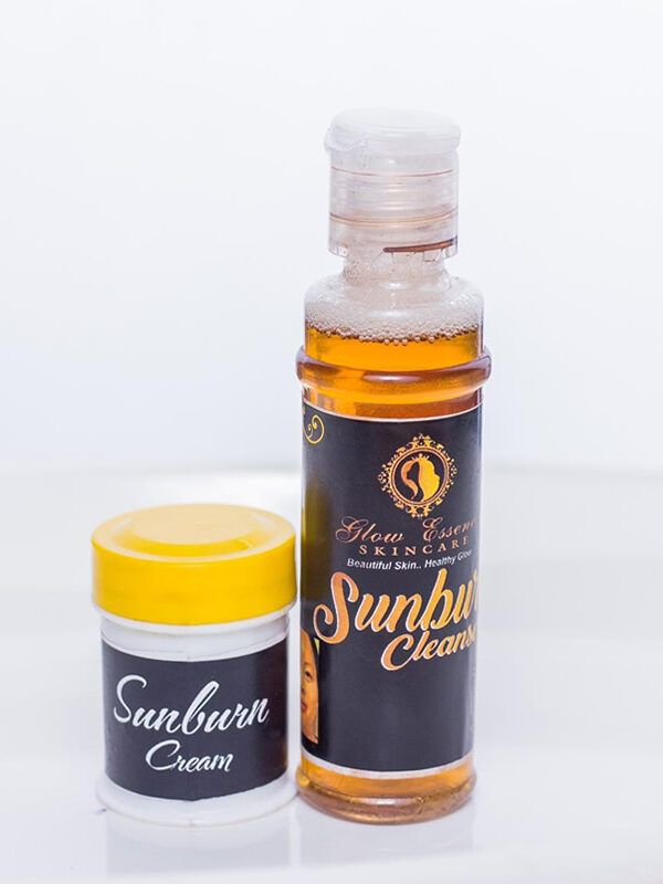 Sunburn Kits