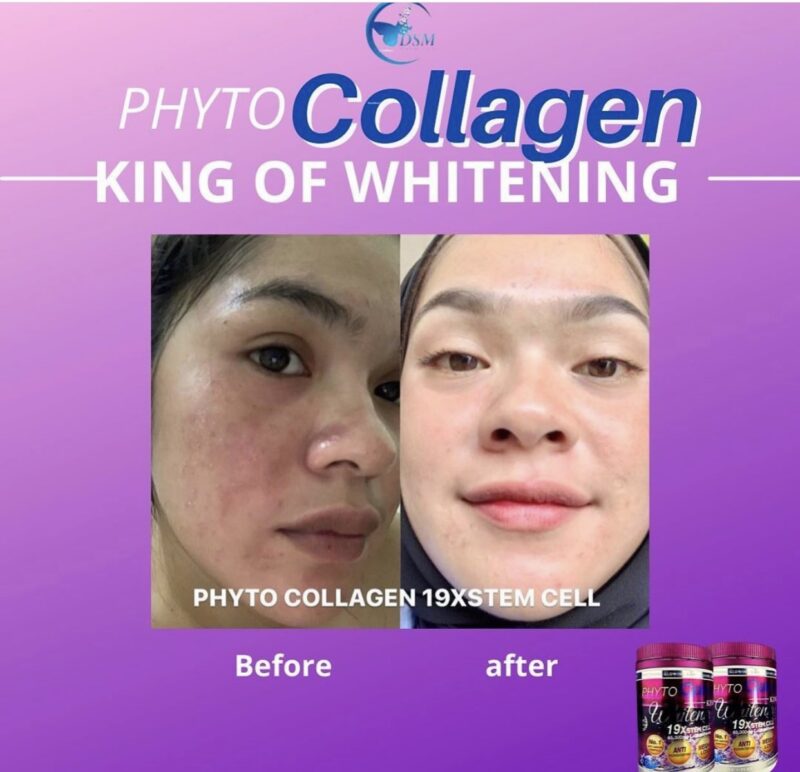 Phyto Collagen