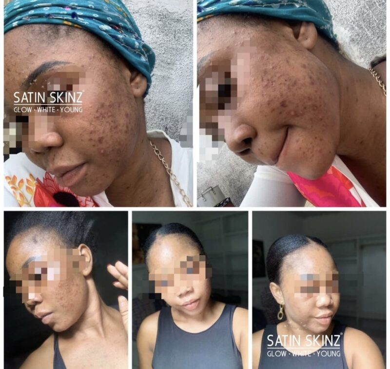 SATIN SKINZ GLUTATHIONE PLUS AND ASTAXNTHIN PLUS ( 2in1) .