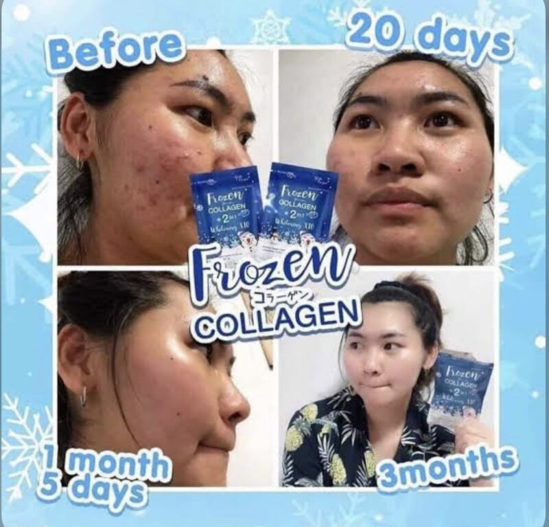 Frozen Collagen 2 in 1 Whitening