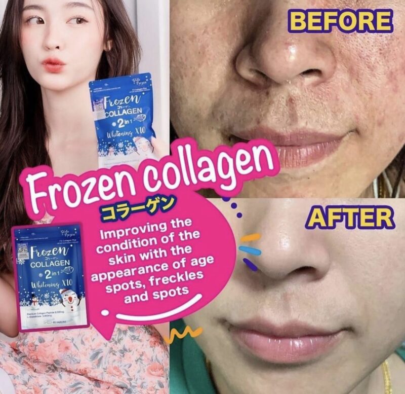 Frozen Collagen 2 in 1 Whitening