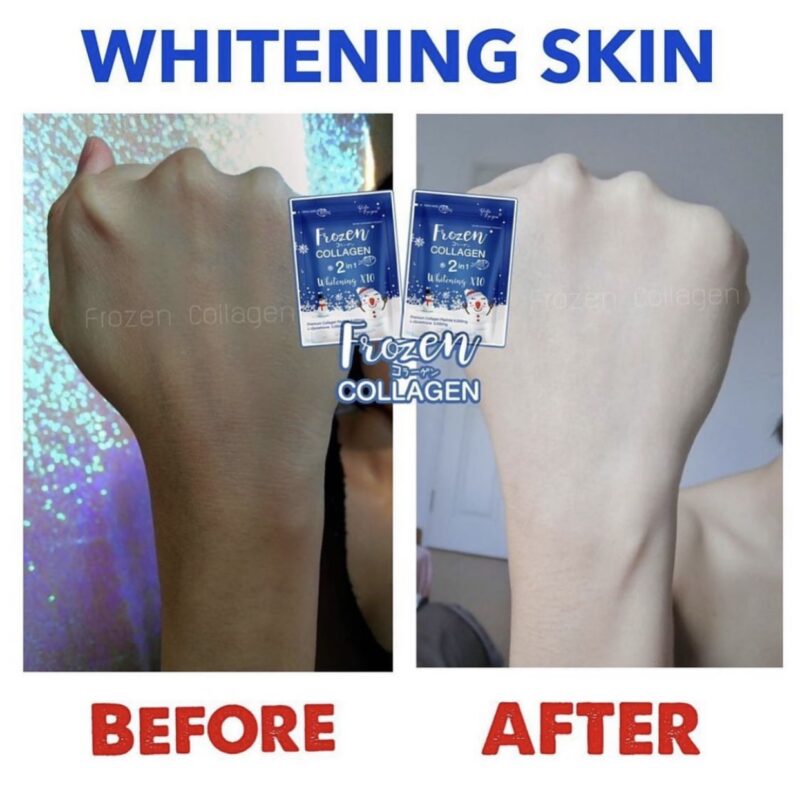 Frozen Collagen 2 in 1 Whitening