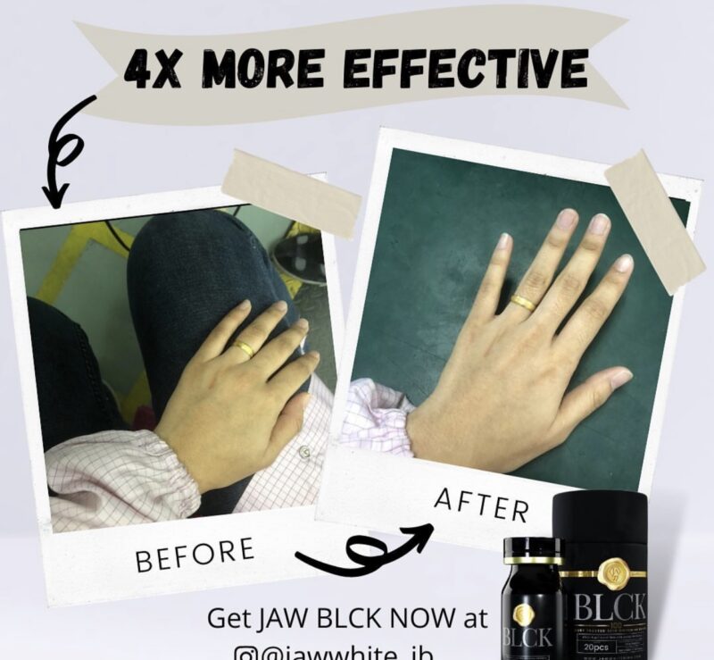 JAW WHITE BLACK EGG CRYSTAL SKIN
