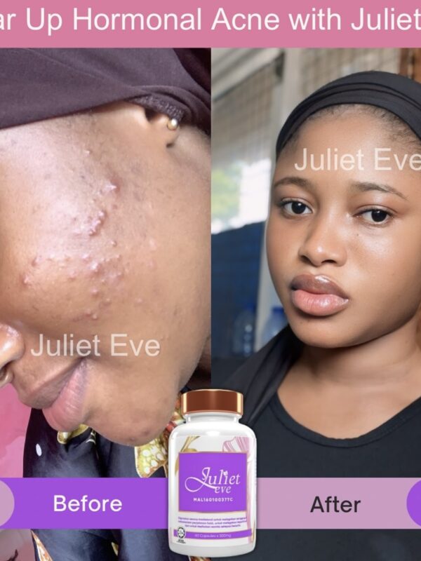 JULIET EVE ( SUPPLEMENT)