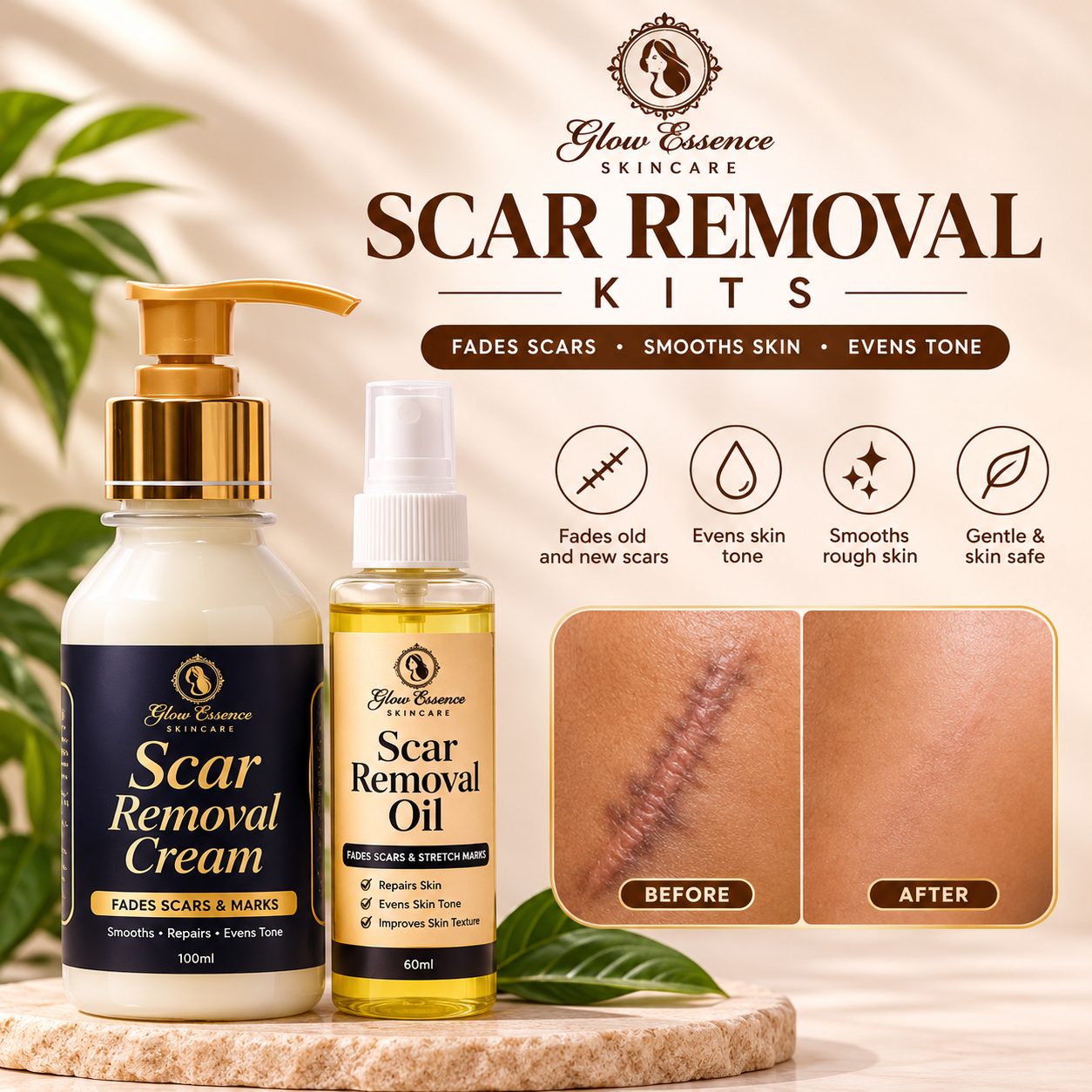 SCAR REMOVAL KITS