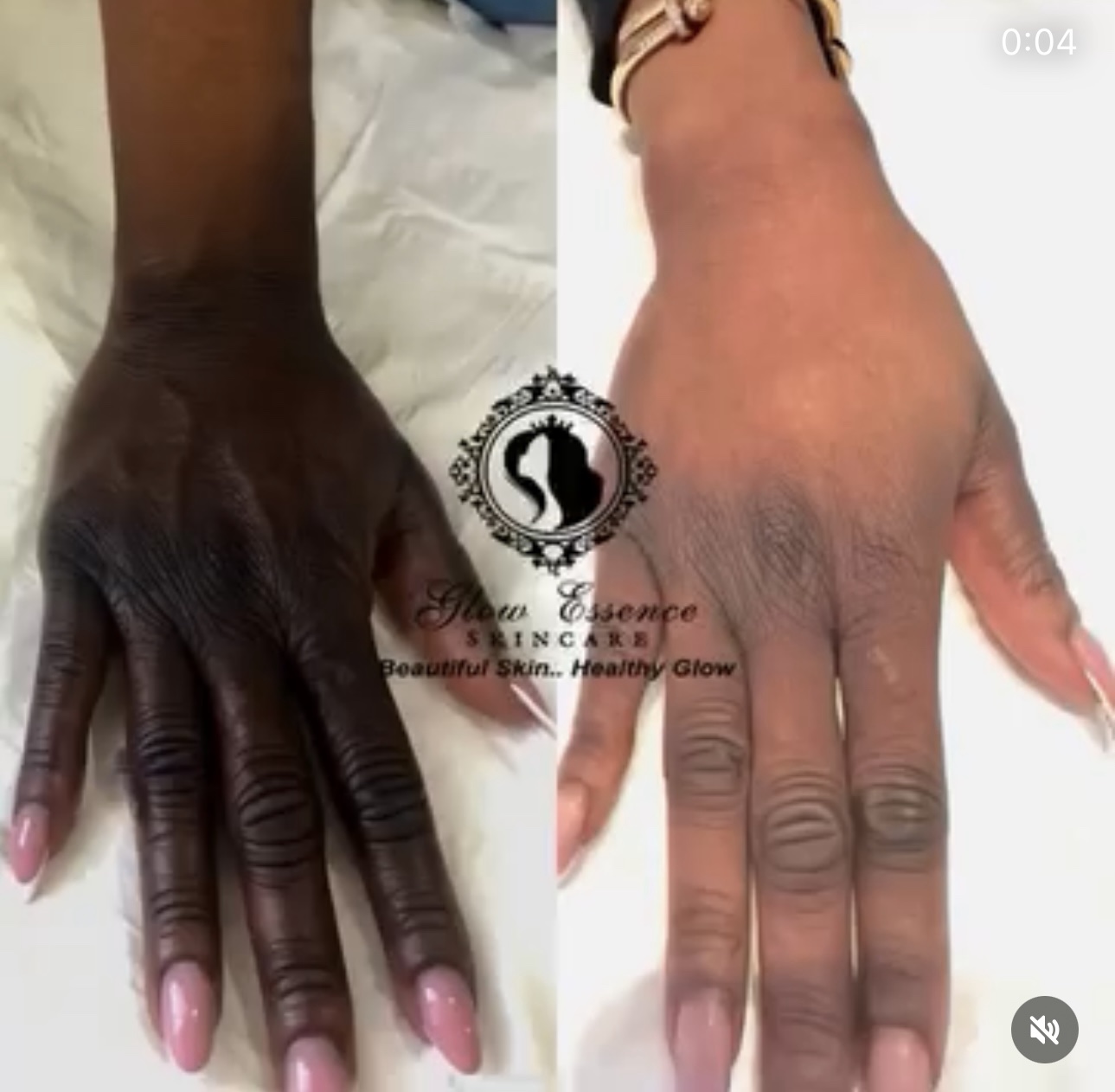 DARK HAND/ FEET COMBO