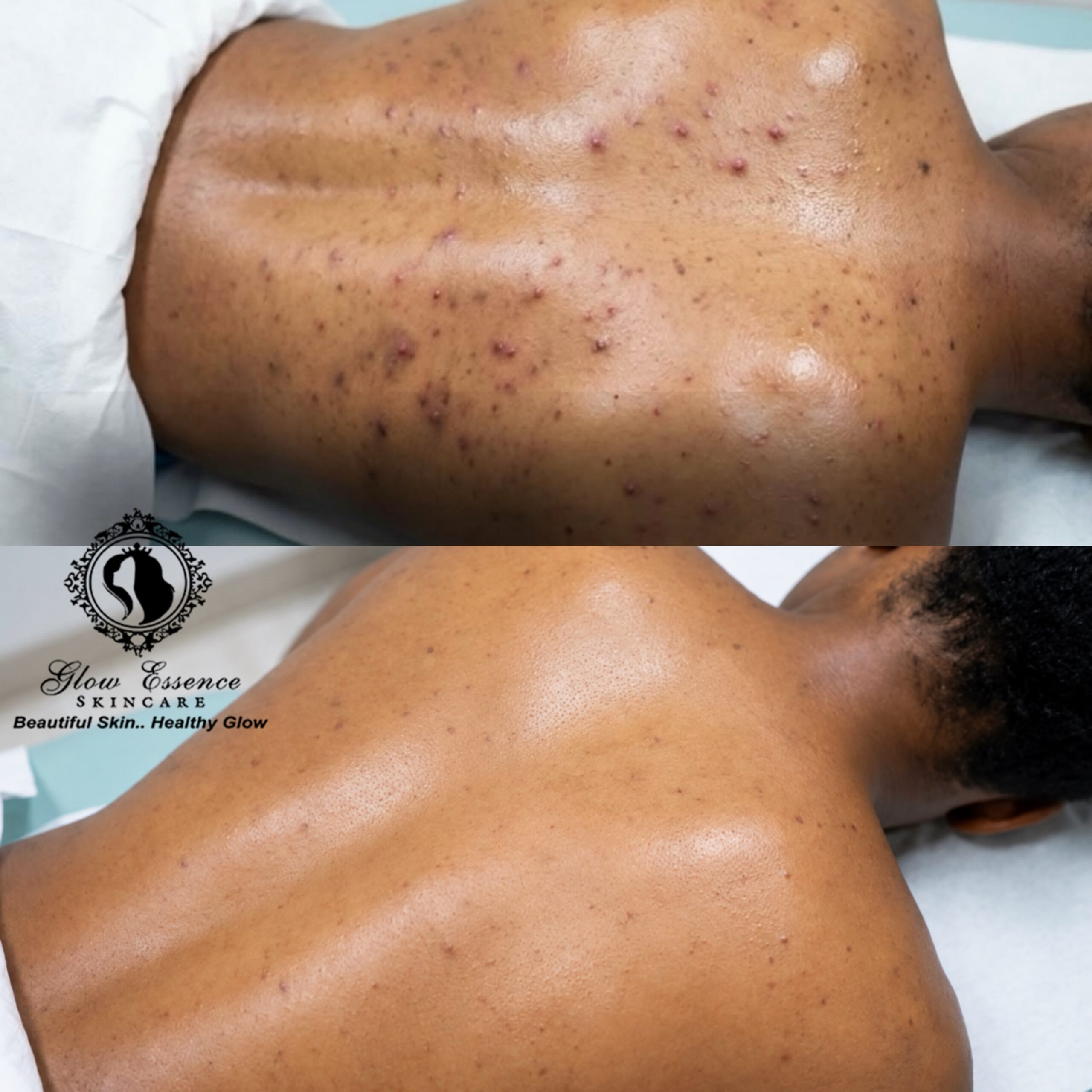 BODY SPOTS REMOVAL COMBO
